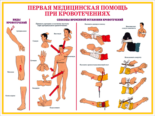 Презентация пп при кровотечениях